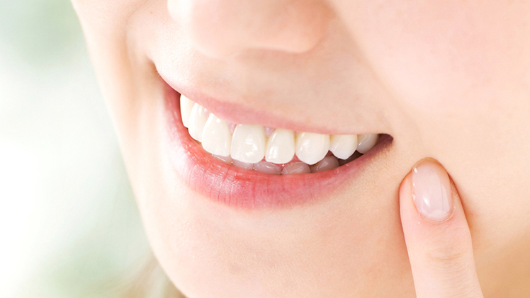 部分矯正で前歯を整えた女性
