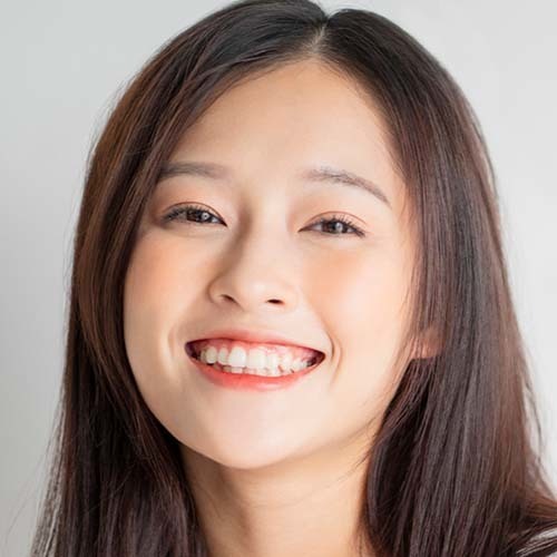 20代向け歯科矯正おすすめ治療の詳細ページへのリンク