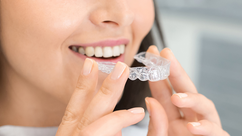 透明なリテーナー装置をつける女性