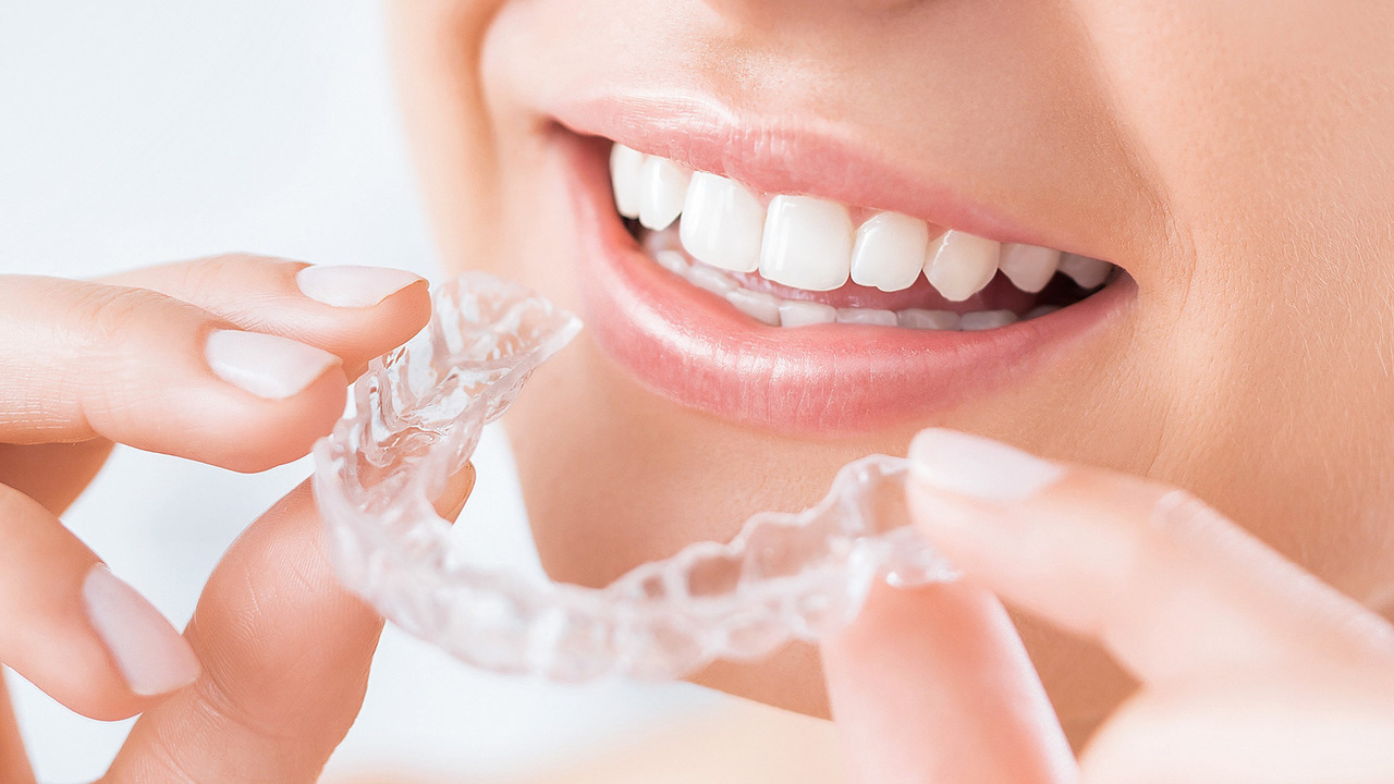 透明なSmile TRUマウスピースを手にする様子