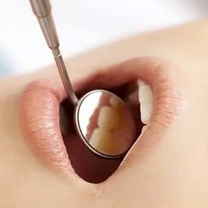 歯科矯正の経過観察中に口腔内チェックを受ける様子