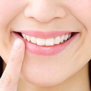 歯の矯正後に笑顔を見せる女性の口元