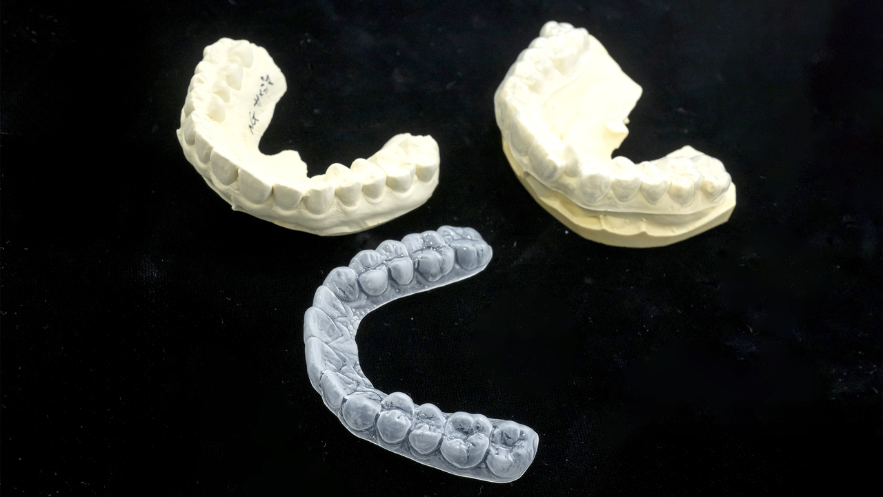 マウスピース矯正の詳細ページへのリンク